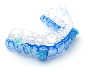 oral-appliance